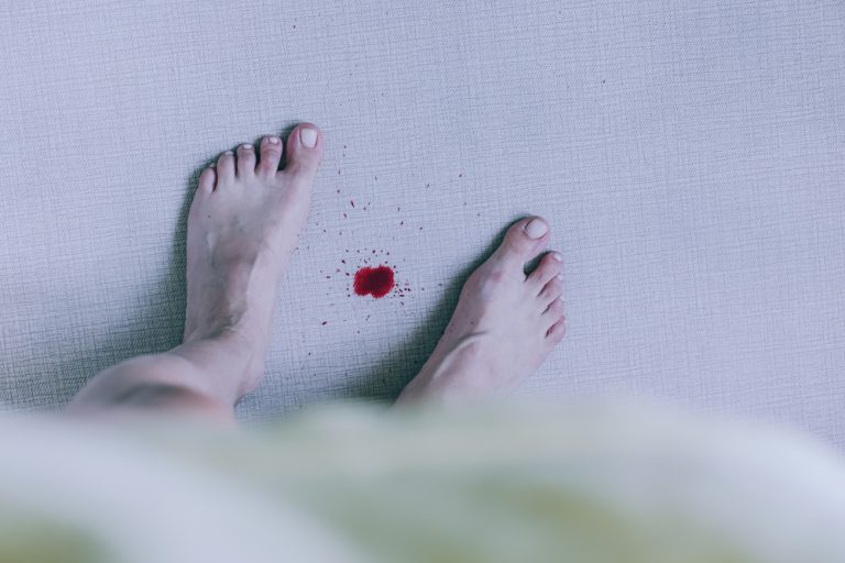 how-to-get-blood-out-of-carpet-8-methods-explained-step-by-step